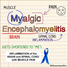 myalgic encephalomyelitis